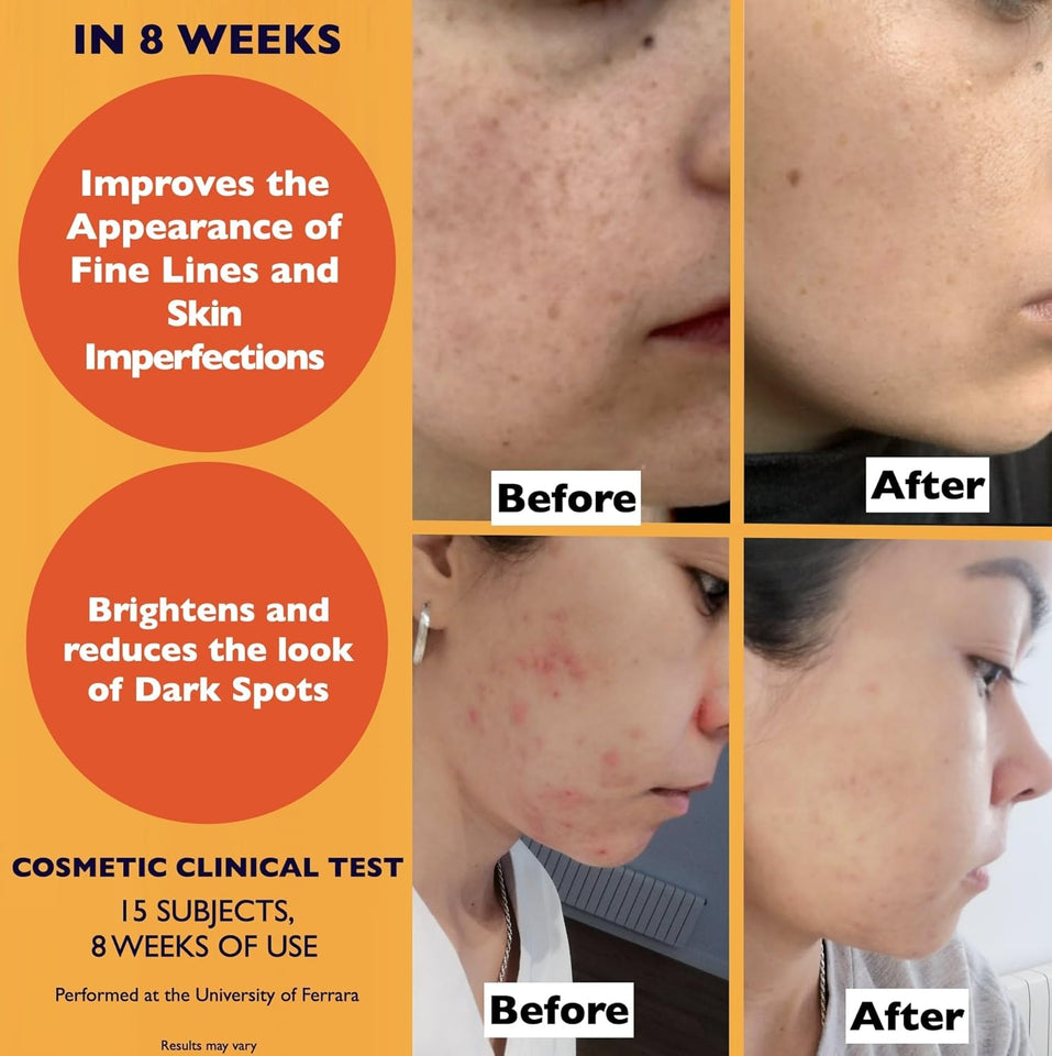 Organic Vitamin C Face Serum 2.11oz with Hyaluronic Acid & Niacinamide for Radiant Skin