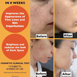 Organic Vitamin C Face Serum 2.11oz with Hyaluronic Acid & Niacinamide for Radiant Skin