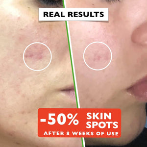 Organic Vitamin C Face Serum 2.11oz with Hyaluronic Acid & Niacinamide for Radiant Skin