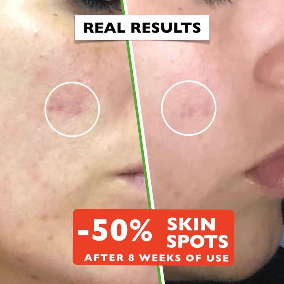 Organic Vitamin C Face Serum 2.11oz with Hyaluronic Acid & Niacinamide for Radiant Skin