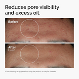 Niacinamide 10% + Zinc 1% Brightening Serum for Blemish-Prone Skin, 30ml | Vegan & Fragrance Free