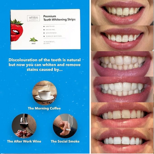 Teeth Whitening Strips for Sensitive Teeth, Enamel-Safe, 14-Day Treatment – 28 Pack