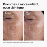 Glycolic Acid 7% Exfoliating Toner for Bright, Smooth & Even-Looking Skin Tone – 240ml