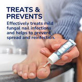 2-in-1 Fungal Nail Treatment Kit 3.8ml | Antifungal Solution with Nail Files, Fast Drying