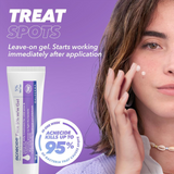 Face Gel Acne Treatment 5% Benzoyl Peroxide for Spot-Prone & Oily Skin, 15g